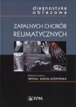 Produkt oferowany przez sklep:  Diagnostyka obrazowa zapalnych chorób reumatycznych