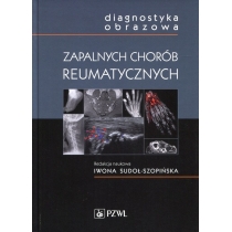 Produkt oferowany przez sklep:  Diagnostyka obrazowa zapalnych chorób reumatycznych